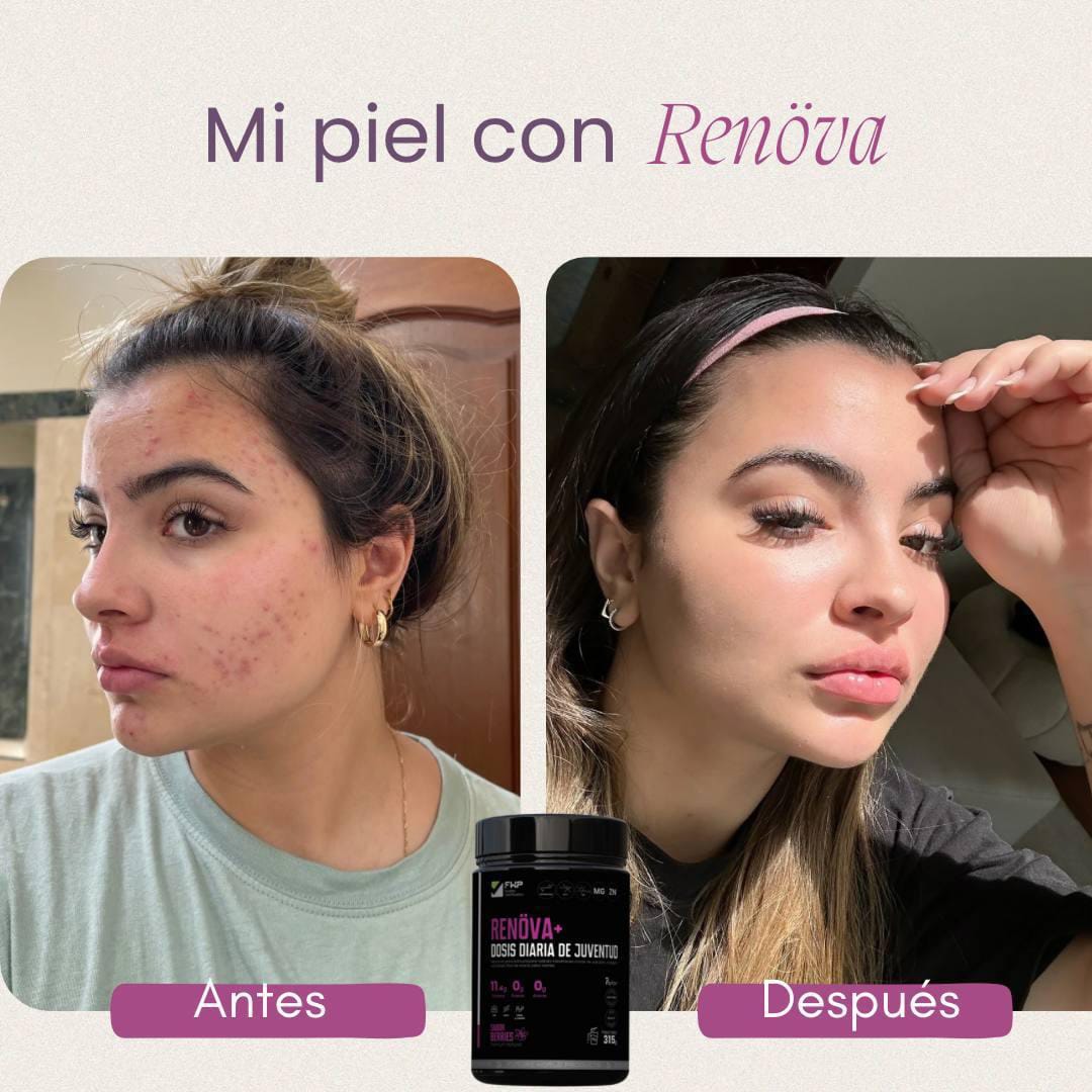 Renova+: Colágeno Hidrolizado Premium en Colombia | Piel y Articulaciones
