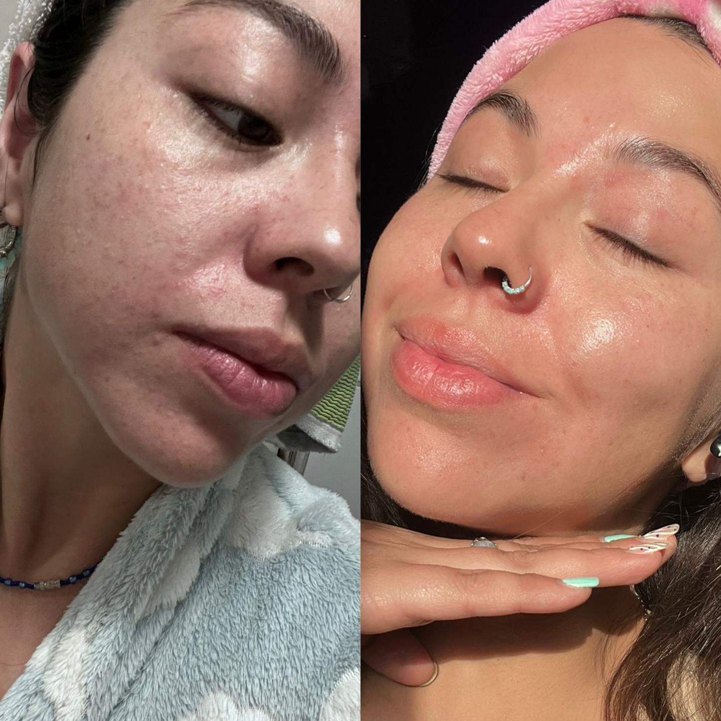 Renova+: Colágeno Doblemente Hidrolizado Premium para Piel y Articulaciones en Chile