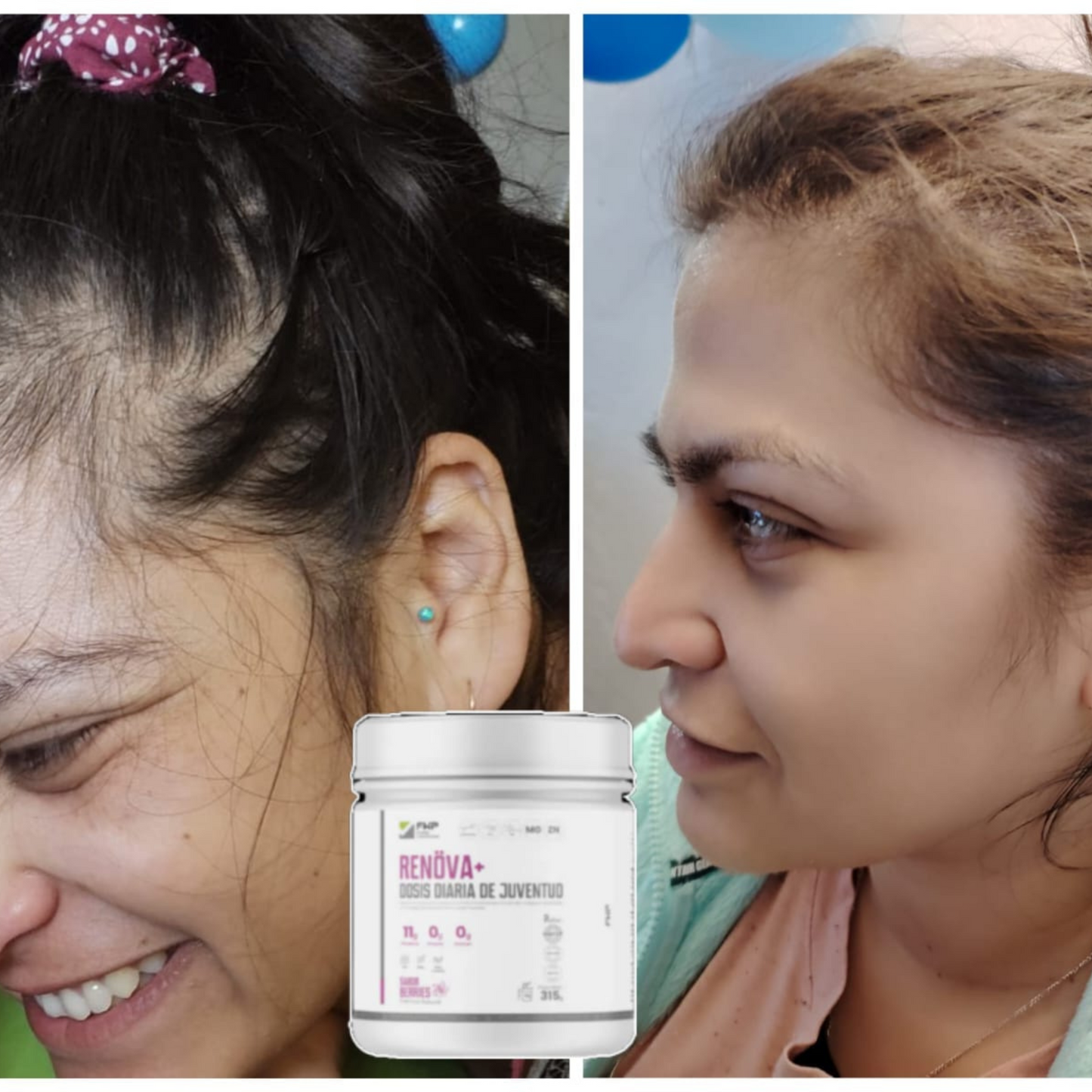 Renova+: Colágeno Doblemente Hidrolizado Premium para Piel y Articulaciones en Chile