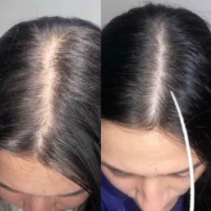 Renova+: Colágeno Doblemente Hidrolizado Premium para Piel y Articulaciones en Chile