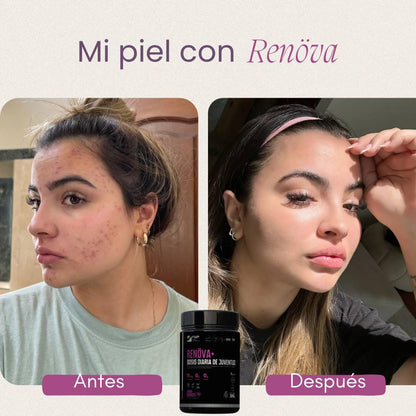 Renova+: Colágeno Hidrolizado Premium en Colombia | Piel y Articulaciones